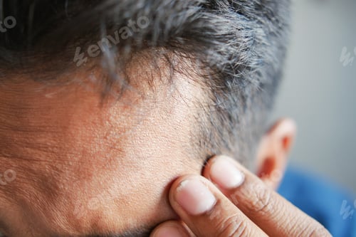 Preview: hair loss concept with man checking his hair