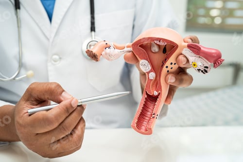 Preview: Uterus, doctor with anatomy model for study diagnosis and treatment in hospital.
