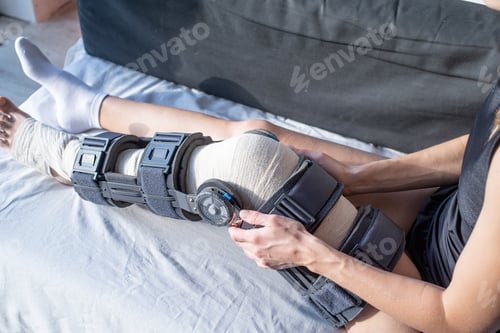 Preview: Female buckling knee orthosis or knee support brace after surgery on leg