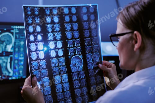 Preview: Caucasian Middle Aged Woman Examining Brain Mri Scans in Medical Office