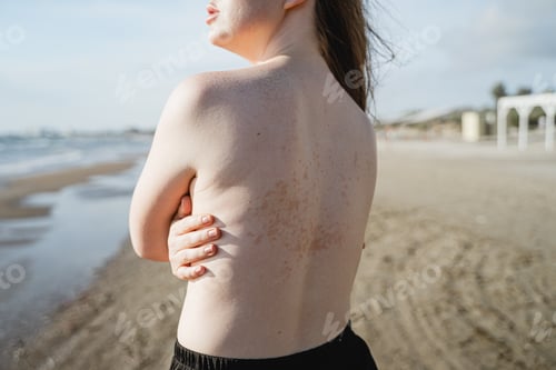 Preview: female back with skin rash