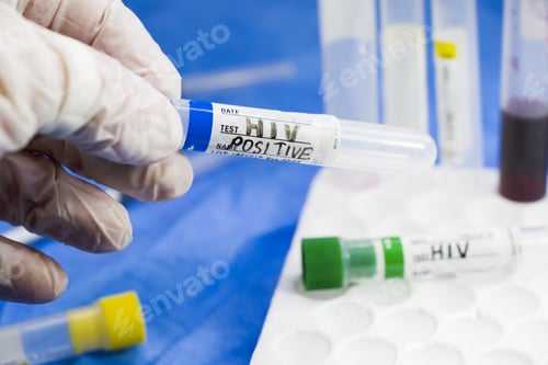 Preview: Closeup of a doctor with a latex glove holding an HIV positive test tube in the laboratory
