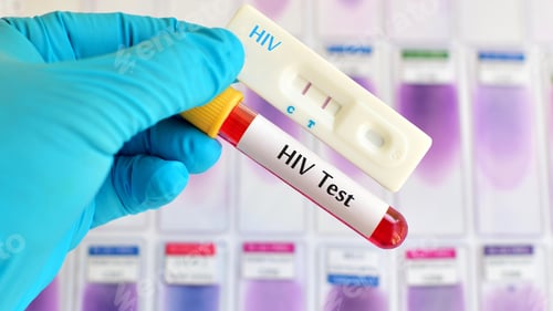 Preview: HIV virus, medical concept, Human Immunodeficiency Virus Positive test
