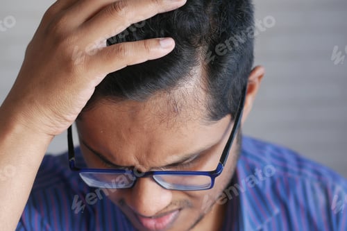 Preview: hair loss concept with man checking his hair