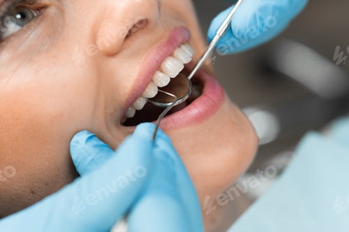 Preview: Close-up of a girl's smile, oral diagnostics by a dentist close-up. The dentist works closely on the