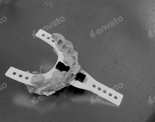 Preview: Healthcare and Medicine! A finished mold of a patient's teeth for a special dental procedure.