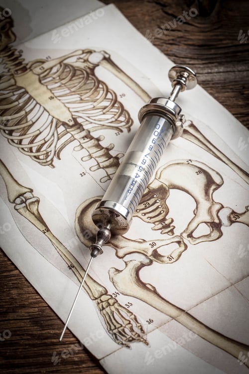 Preview: Old medical instruments.