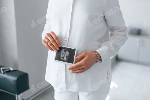 Preview: Woman in white coat is holding ultrasound picture of baby photo