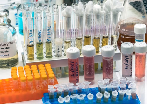 Preview: Vials with samples of SARS-COV-2 Covid-19 in a research laboratory, conceptual image
