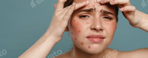 Preview: Ginger shirtless woman frowning and squeezing pimple on her face
