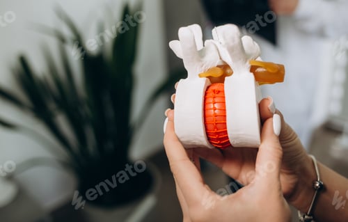 Preview: Model of human spine with inflamed intervertebral hernia on black background. Intervertebral