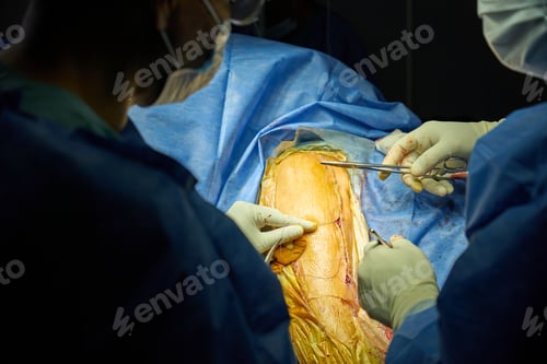 Preview: Surgeons Performing Knee Surgery in an Operating Room