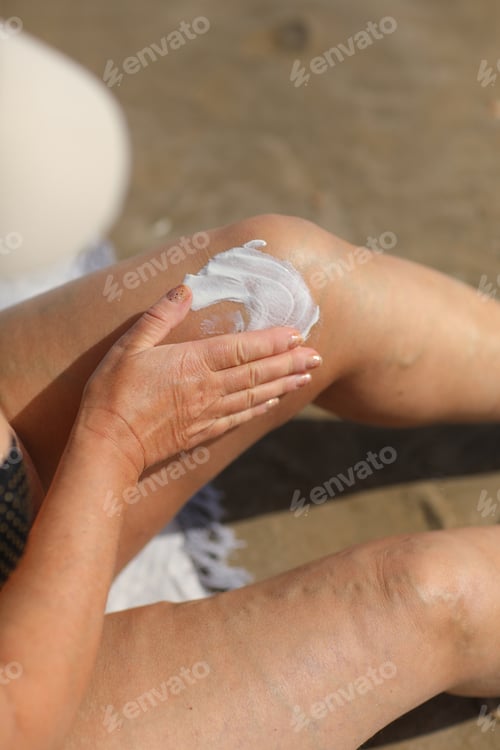 Preview: overweight woman applying sunscreen lotion on her legs with varicose veins, close up detail.