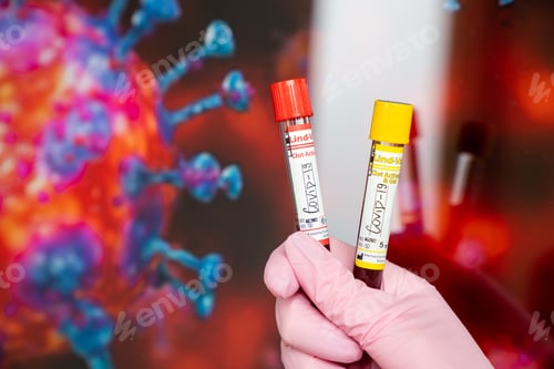 Preview: Doctor holding the testing samples of Covid-19