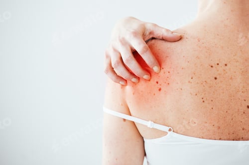 Preview: cropped view of sick woman with allergy scratching red skin on hand isolated on white
