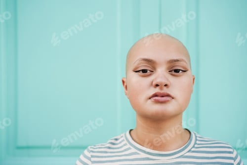 Preview: Young bald girl looking at camera outdoor in the city - Focus on face