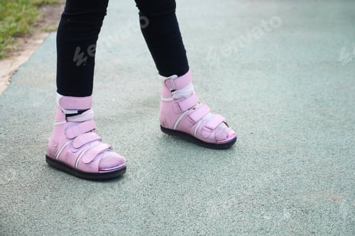 Preview: Child cerebral palsy disability, legs orthosis.