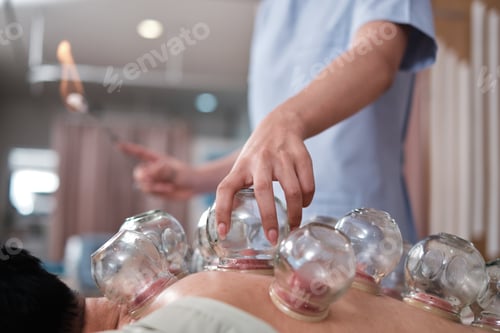 Preview: A cupping therapy for pain relief by physical therapist, oriental treatment.