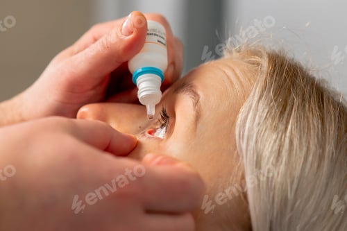 Preview: close-up in an ophthalmology clinic Freezing drops are put into a girl's eye