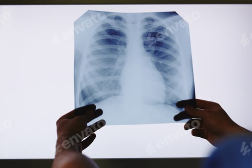 Preview: Holding x-ray