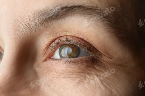 Preview: Closeup view of mature woman with cataract