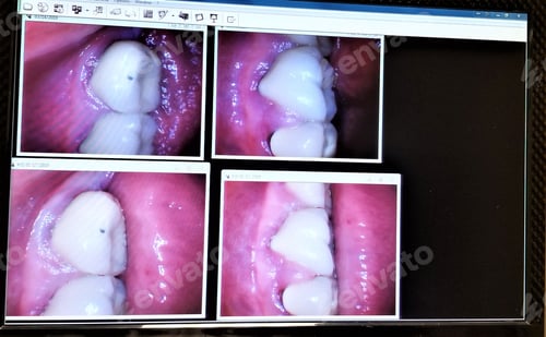 Preview: Dentistry! Oral Healthcare! Dental Photos!