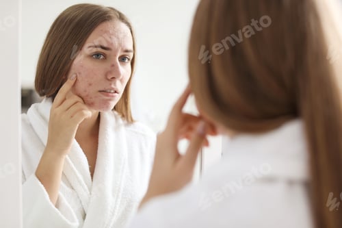Preview: Young woman with acne problem near mirror in bathroom