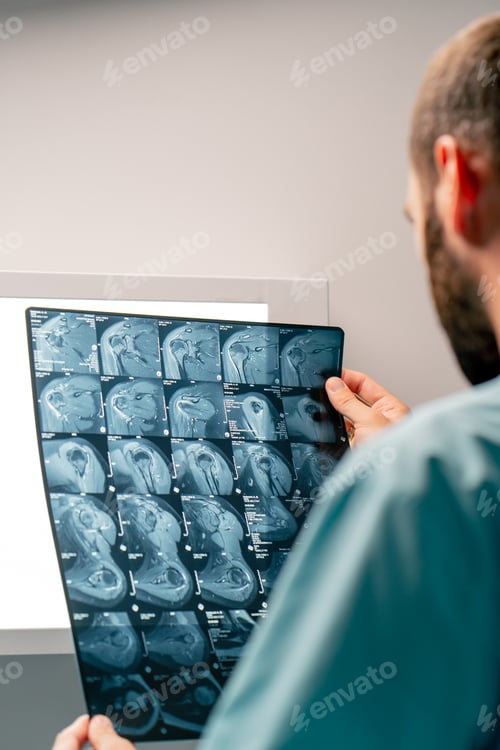 Preview: frame of an MRI image on a special board accurate and detailed a description of image and diagnosis