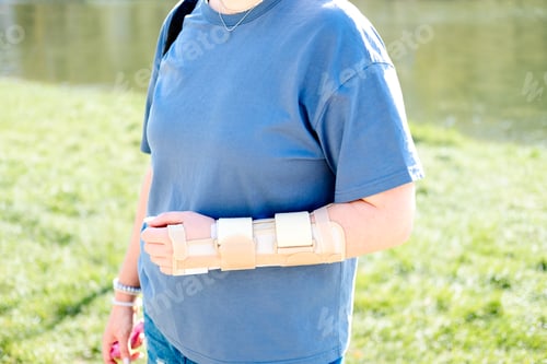 Preview: A woman's hand with a beige brace in a summer park, close-up