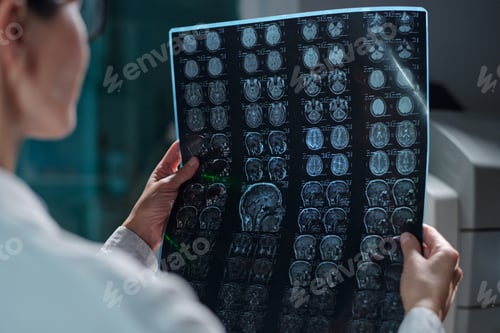 Preview: Examining Diagnostic Brain Scans for Patient Evaluation