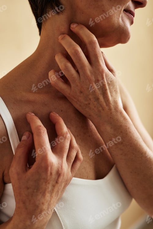 Preview: Close up of unrecognizable woman scratching neck itch and allergy