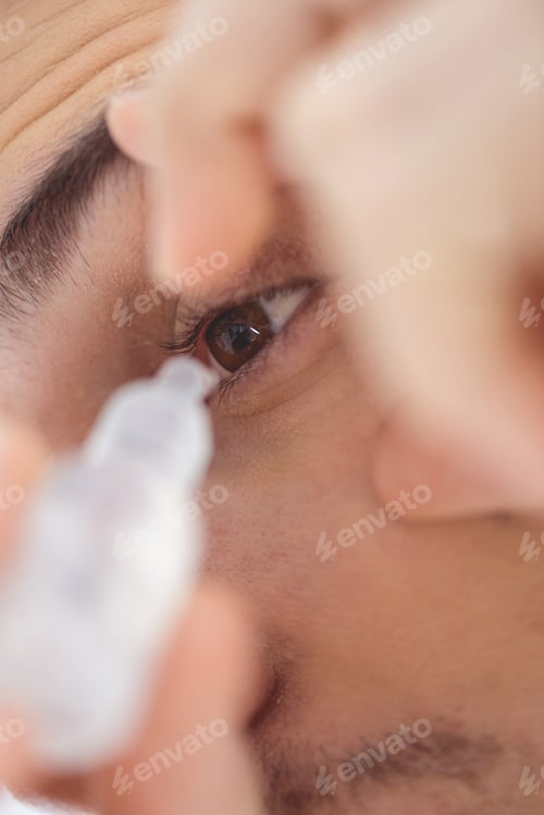 Preview: close up view of young man applying eye drop