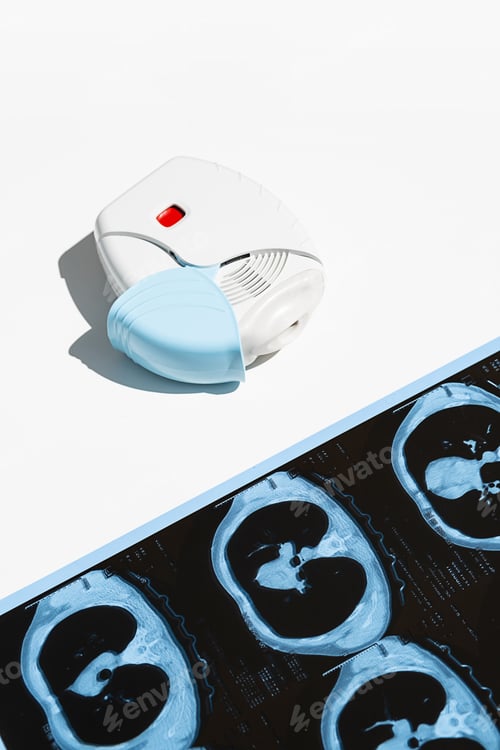 Preview: Asthma Inhaler and CT Scan of the Lungs on White Table.