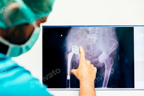 Preview: Medicine doctor looking x-ray image.