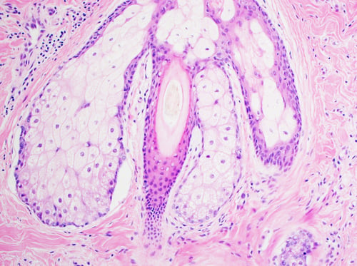 Preview: H&E stain, light microscopy, normal hair follicle