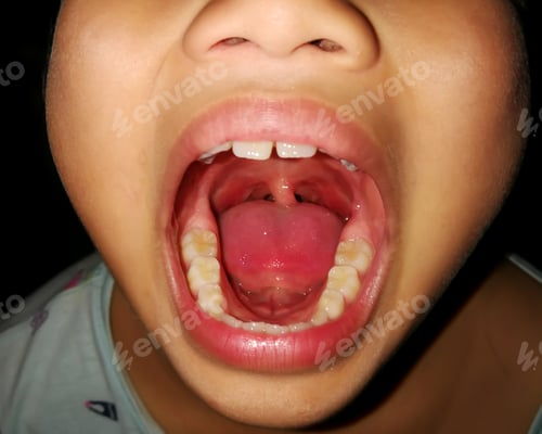 Preview: Young child showing sore throat to the doctor.