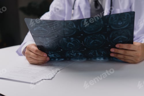 Preview: Doctor holding x-ray film before surgery. MRI and CT scan examining at diagnosing patient’s