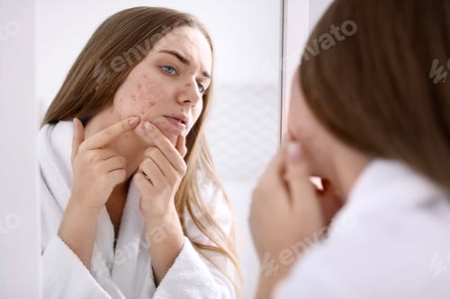 Preview: Young woman with acne problem near mirror in bathroom