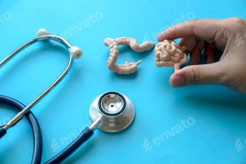 Preview: Concept of Colonic disease