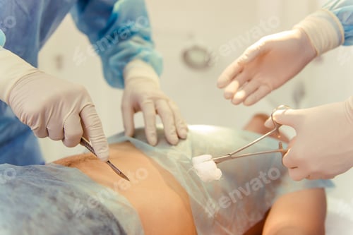 Preview: Surgical Procedure With Patient and Medical Staff