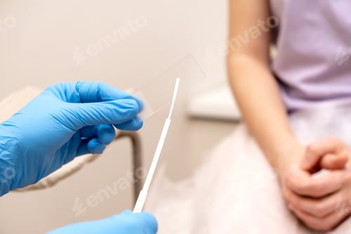 Preview: The gynecologist examines the patient, takes a sample of the biomaterial on a slide.