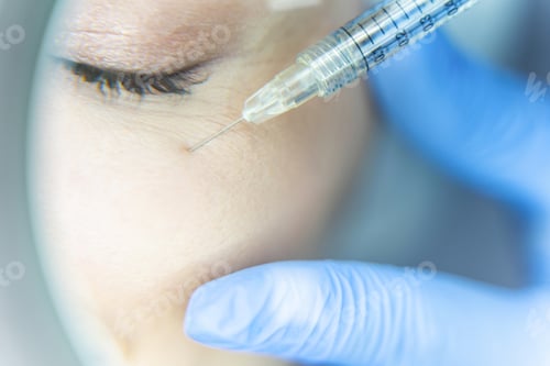 Preview: Woman is being injected around crows feet