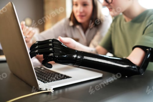 Preview: Woman learning to use her prosthesis