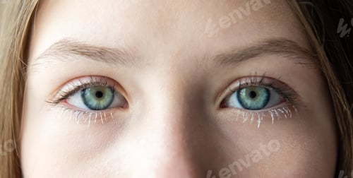 Preview: Stye, hordeolum, bacterial infection of oil gland in eyelid. Blepharitis. Eye health. Sick kid