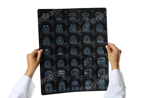 Preview: PNG, MRI images of a human head in the hands of a doctor, isolated on white background