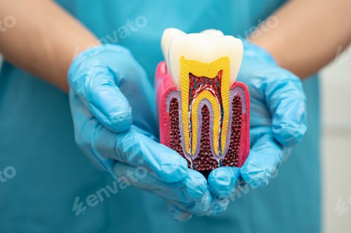 Preview: Asian dentist holding dental implant, artificial tooth roots into jaw, root canal