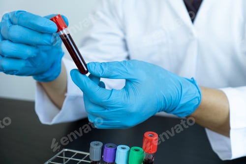 Preview: Male doctors are working with blood samples in the laboratory to check for infections in the blood.