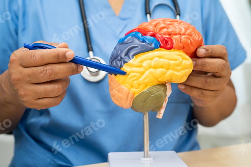 Preview: Alzheimer disease, Asian doctor holding brain anatomy model