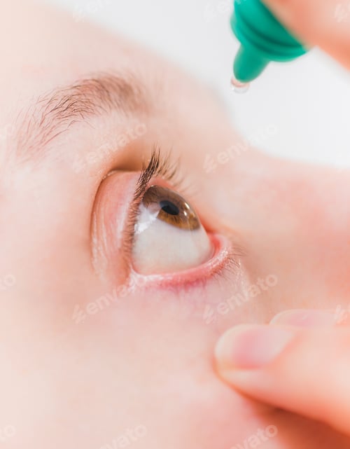 Preview: Close up of woman instilling eye drops, ophthalmology, optometry graphic
