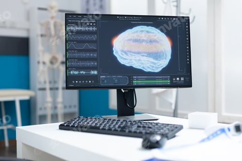 Preview: Computer with brain ct scan on screen standing on table in empty doctors office
